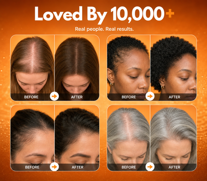 Eleve™ Hair Growth Serum